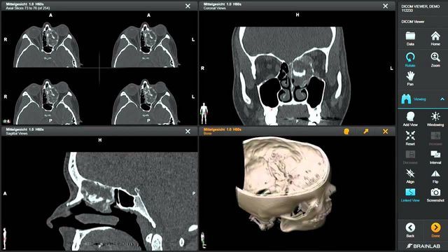 Dicom Viewer Free Download For Mac